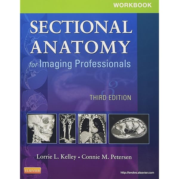 Sectional Anatomy for Imaging Professionals: 9780323082600